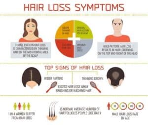 Hair-Loss-Symptoms-470x400
