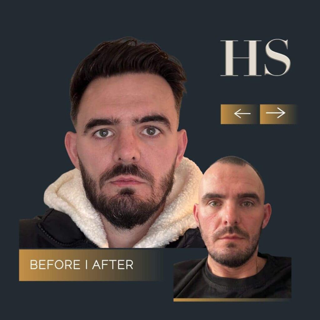 Home 5 Home 3